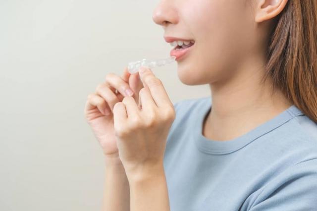 How Long Does Invisalign Treatment Take and What Factors Affect the Timeline?